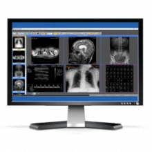 Sante PACS Server 4.3.1